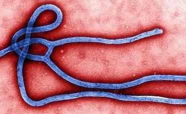 아산도 ‘에볼라’ 안전대책 강구해야
